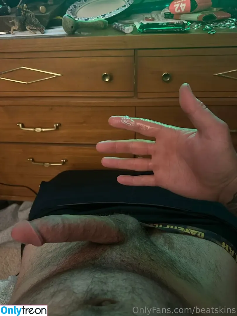 beatskins nude photo #0021 (thebearskinsband)