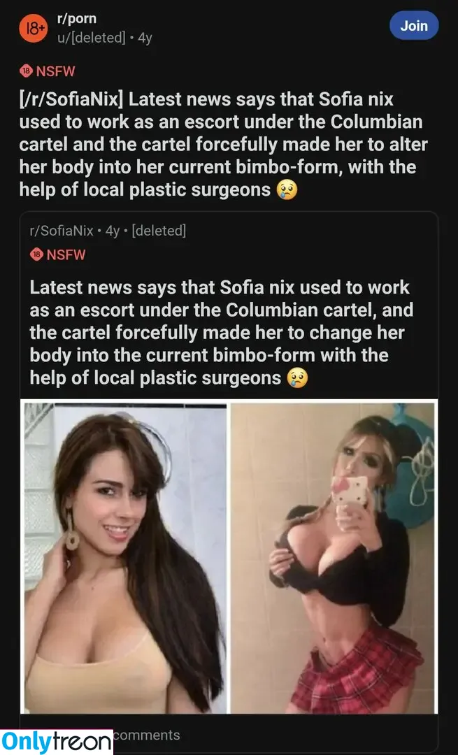 Before and After : Pornstar Boobjobs nude photo #0022 (_celebrities_before_after_)