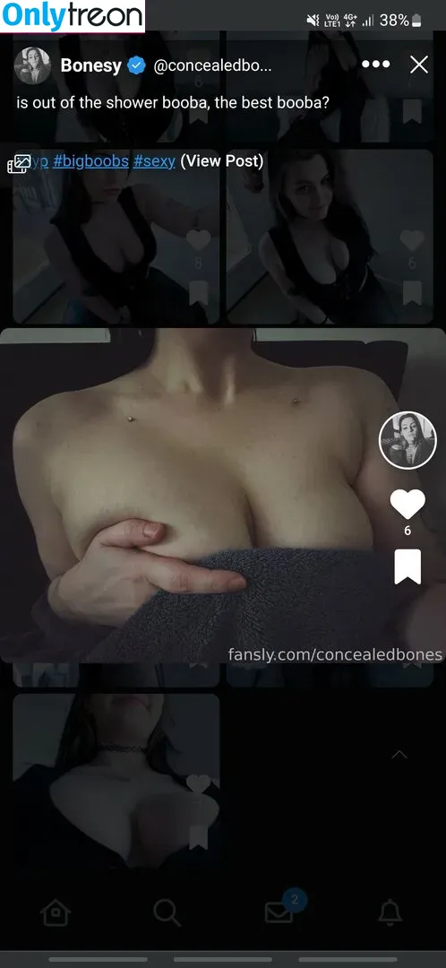 ConcealedBones nude photo #0121 (ConcealedBones)
