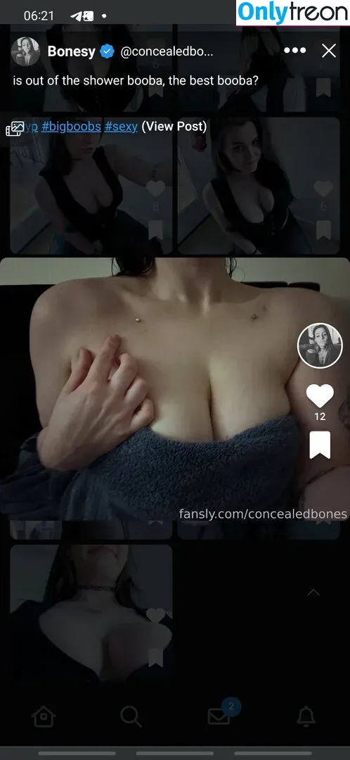 ConcealedBones nude photo #0122 (ConcealedBones)