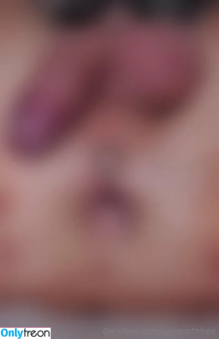 uglynorthfree nude photo #0038 (uglynorthfree)