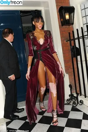 Winnie Harlow / winnieharlow nude photo #0524