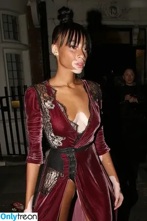Winnie Harlow / winnieharlow nude photo #0526
