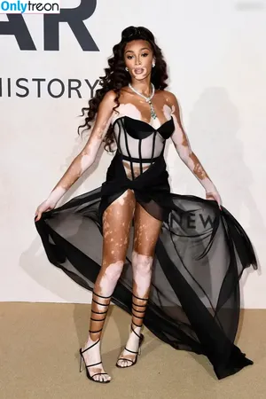 Winnie Harlow / winnieharlow nude photo #0537