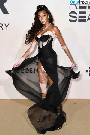 Winnie Harlow / winnieharlow nude photo #0538