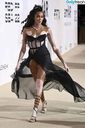 Winnie Harlow / winnieharlow nude photo #0542