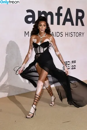 Winnie Harlow / winnieharlow nude photo #0545