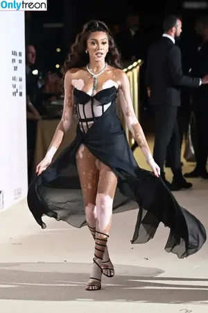 Winnie Harlow / winnieharlow nude photo #0548