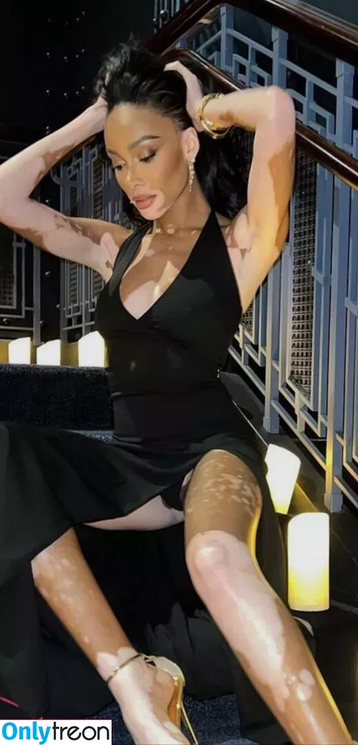 Winnie Harlow nude photo #0001 (winnieharlow)