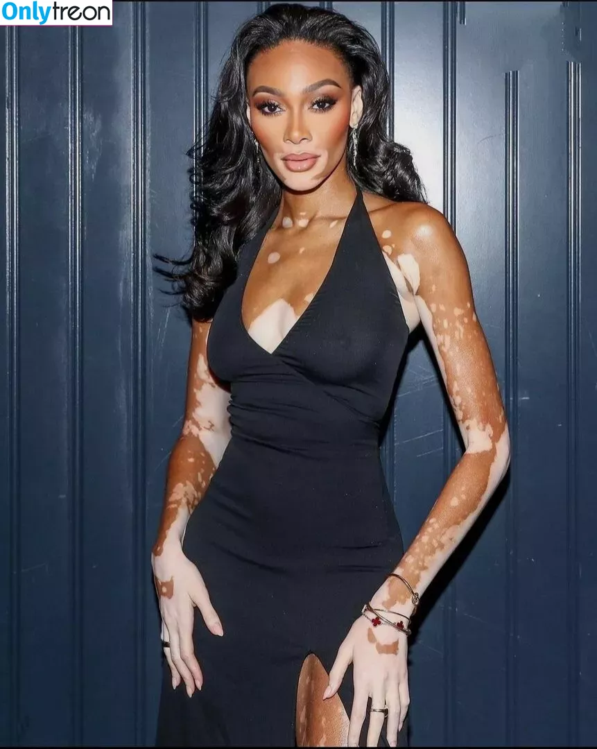 Winnie Harlow nude photo #0003 (winnieharlow)