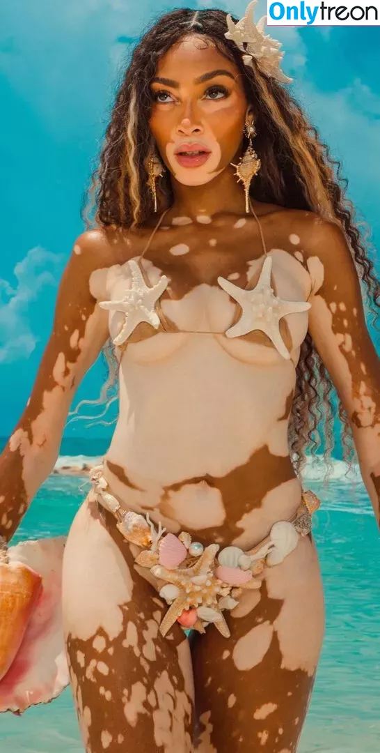 Winnie Harlow nude photo #0347 (winnieharlow)
