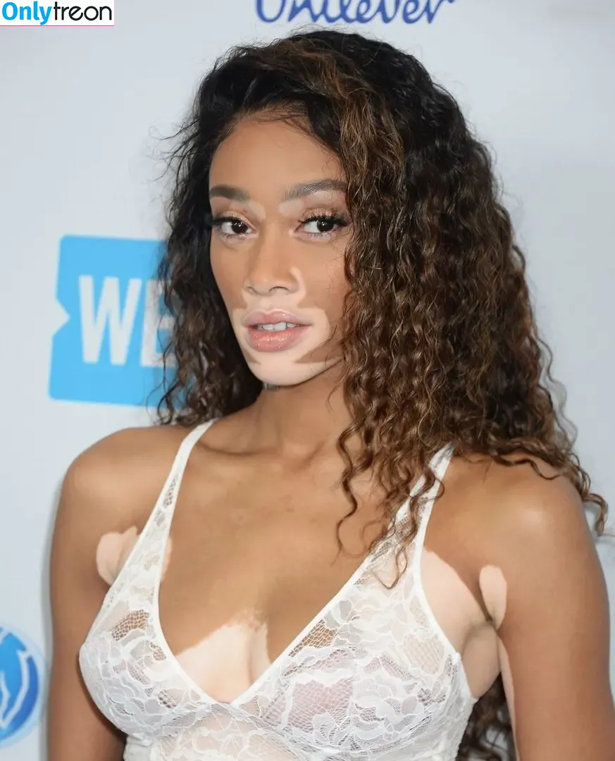 Winnie Harlow nude photo #0528 (winnieharlow)