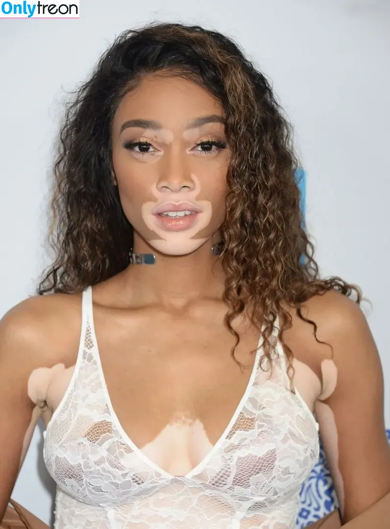 Winnie Harlow nude photo #0529 (winnieharlow)