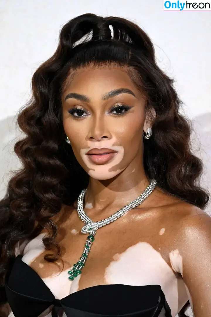 Winnie Harlow nude photo #0534 (winnieharlow)