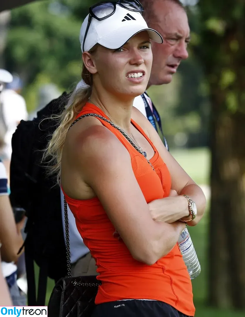 Caroline Wozniacki nude photo #0034 (CaroWozniacki)
