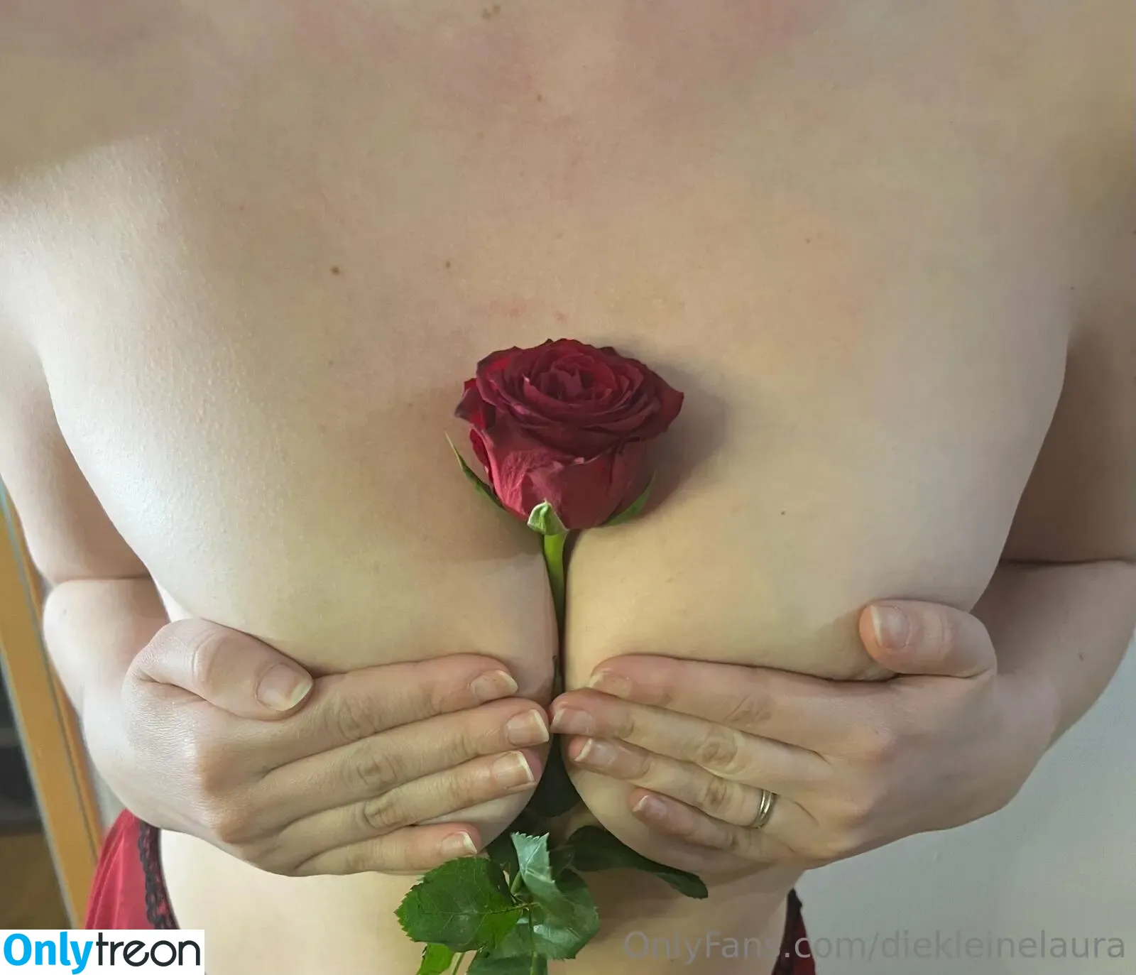 diekleinelaura nude photo #0009 (diekleinee)
