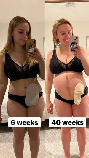Hannah Witton / hannahwitton фото голая #0045