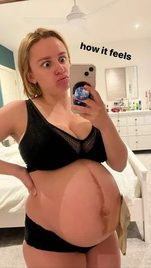 Hannah Witton / hannahwitton фото голая #0046