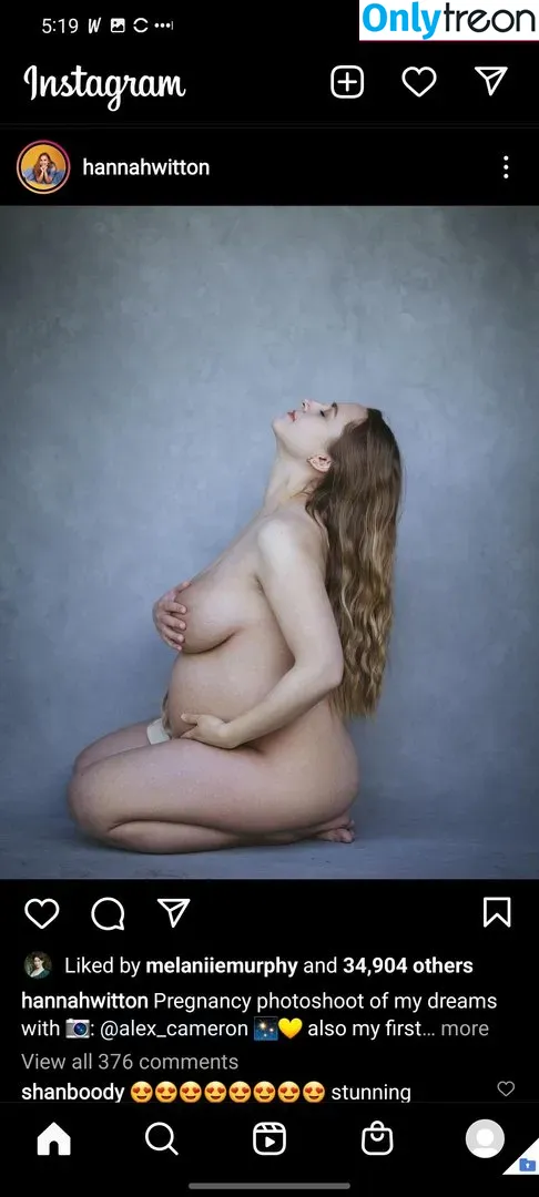 Hannah Witton голая photo #0024 (hannahwitton)
