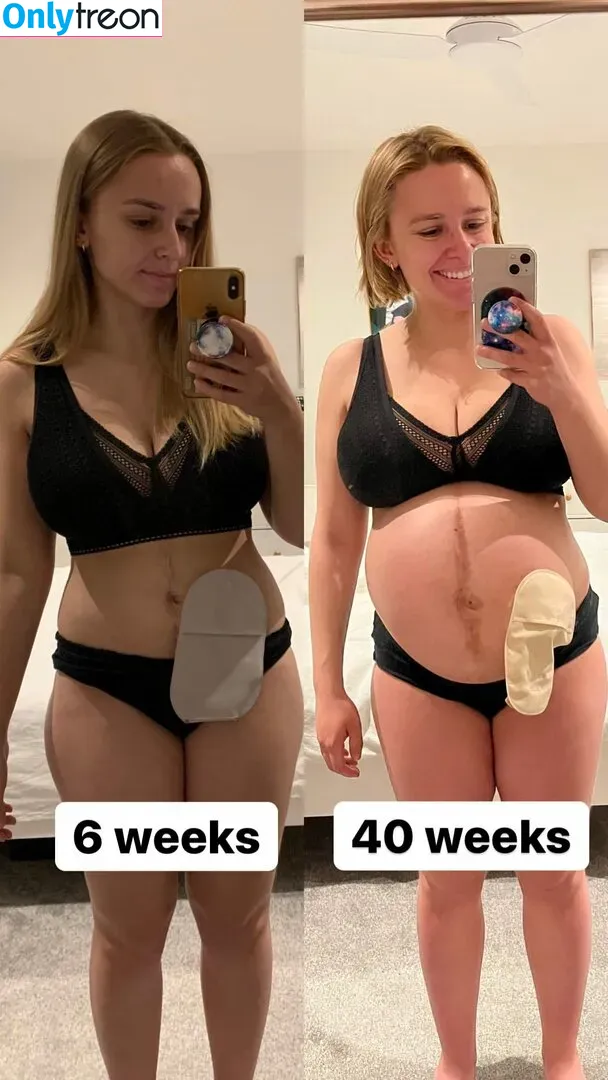 Hannah Witton голая photo #0045 (hannahwitton)