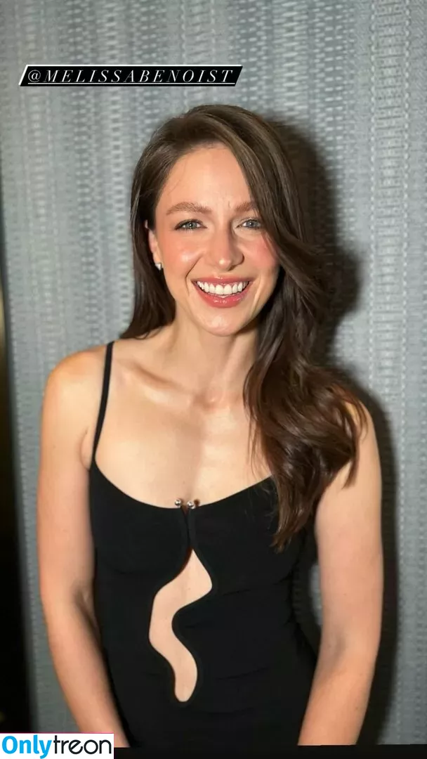 Melissa Benoist nude photo #0215 (melissabenoist)