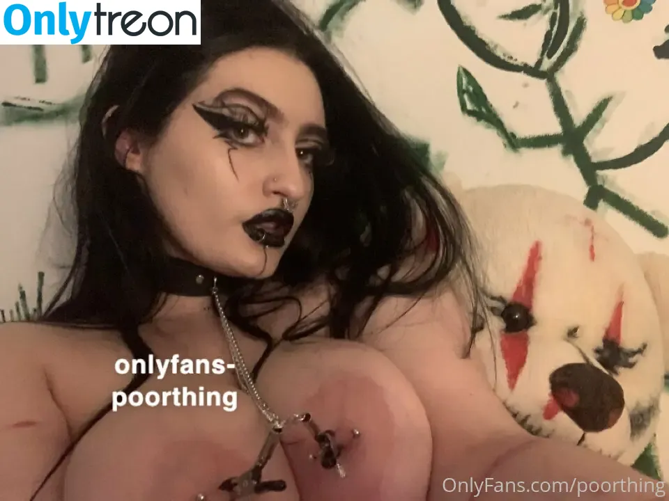poorthing голая photo #0016 (poorthingsfilm)