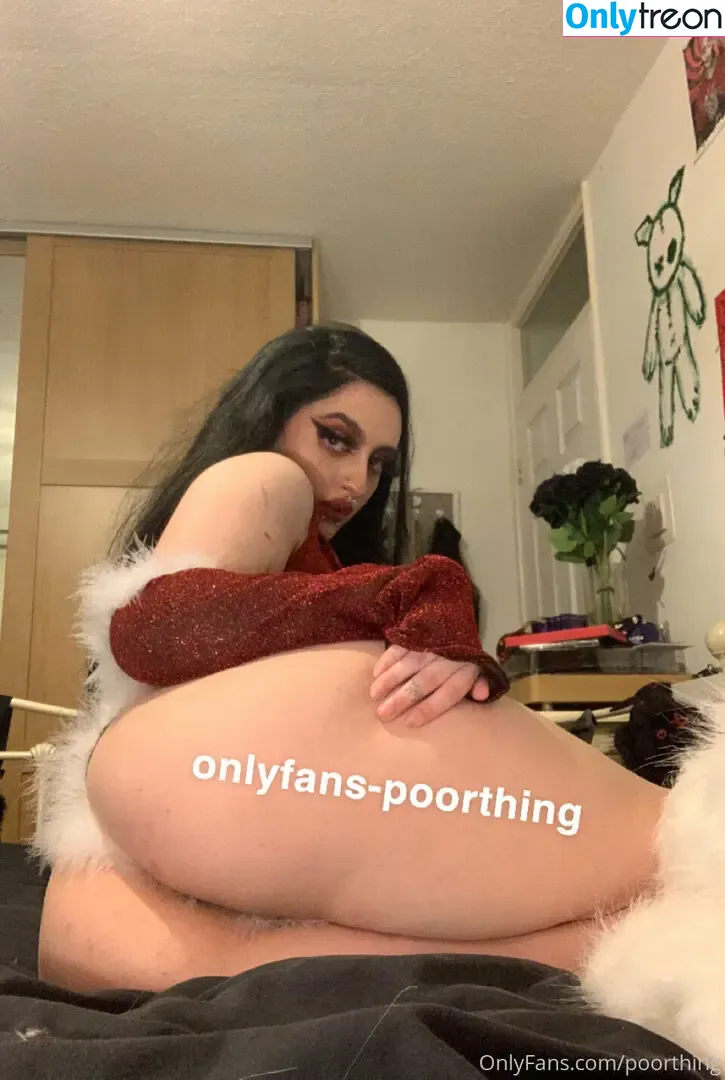 poorthing nude photo #0052 (poorthingsfilm)