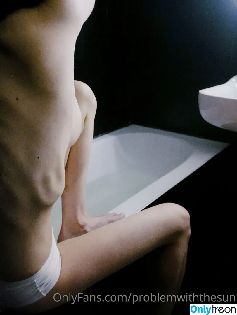 problemwiththesun nude photo #0004 (PEOPLEFROMTHELITTLETOWN / problem_with_the_sun / sun_problem)