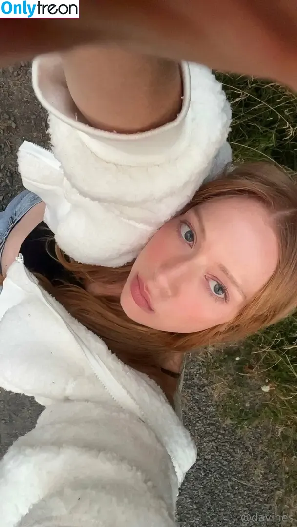 roisonheart nude photo #0091 (roisonheart)