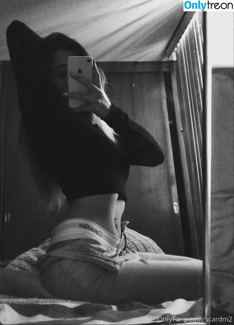 scardm2 nude photo #0001 (scar_lip)