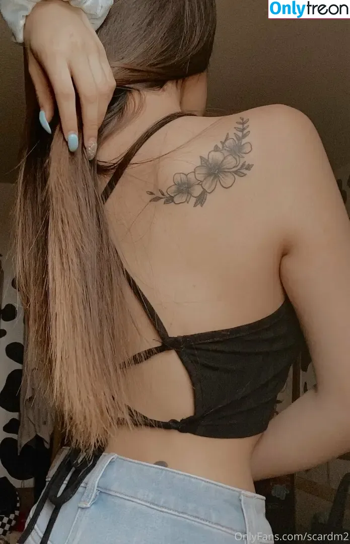 scardm2 nude photo #0016 (scar_lip)