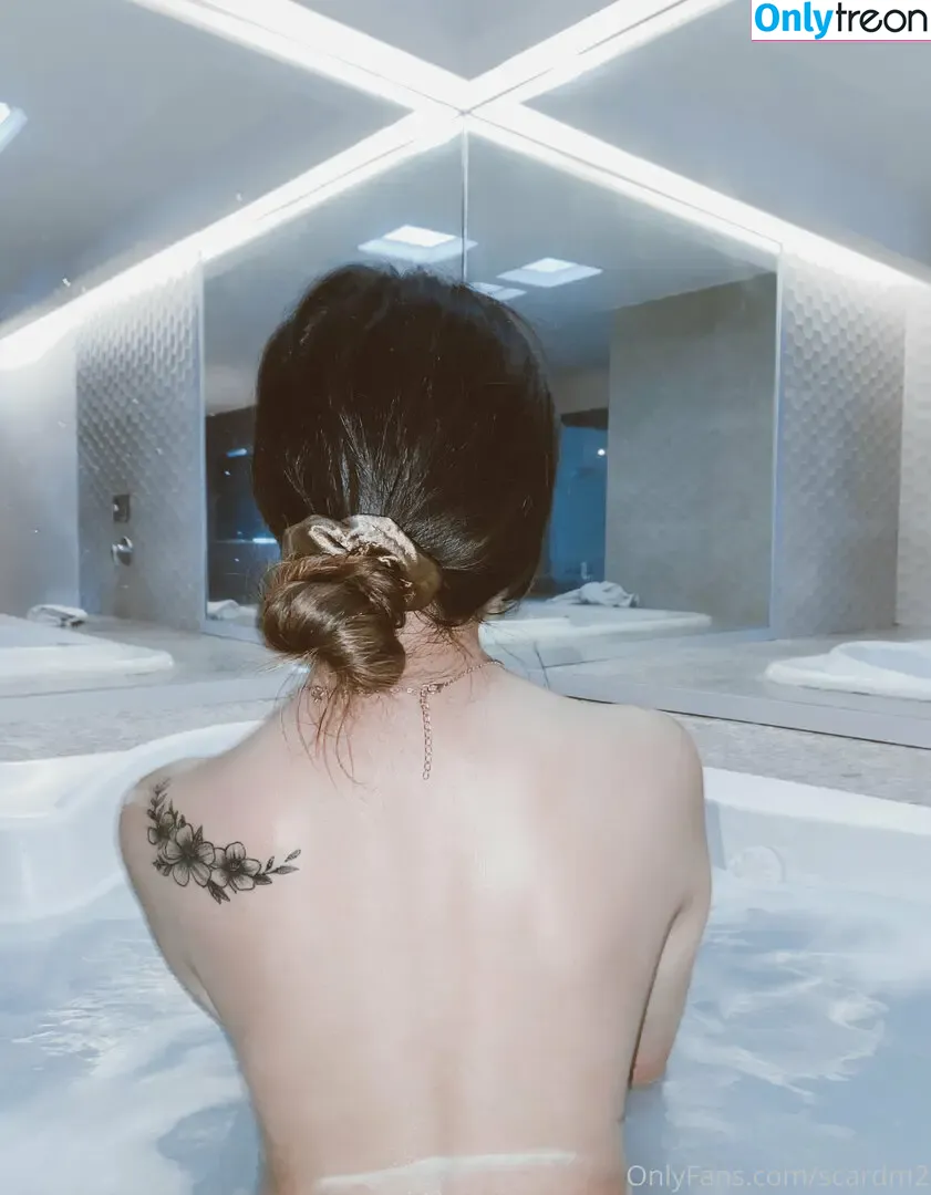 scardm2 nude photo #0025 (scar_lip)