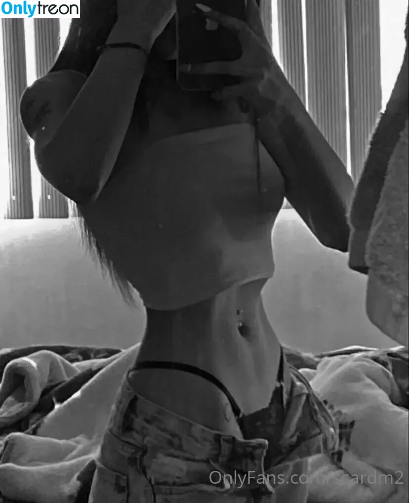 scardm2 nude photo #0044 (scar_lip)
