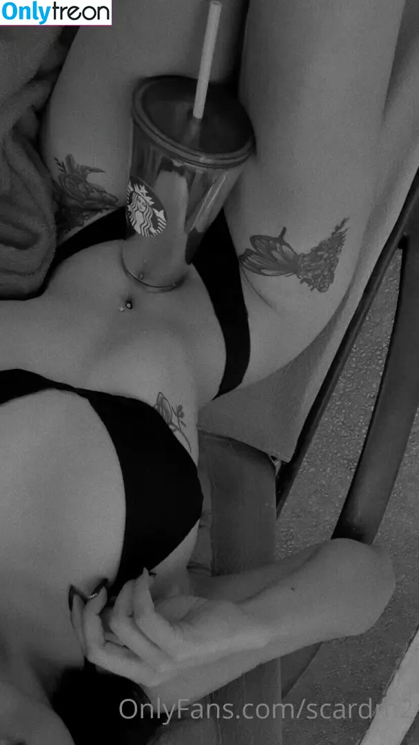 scardm2 nude photo #0049 (scar_lip)