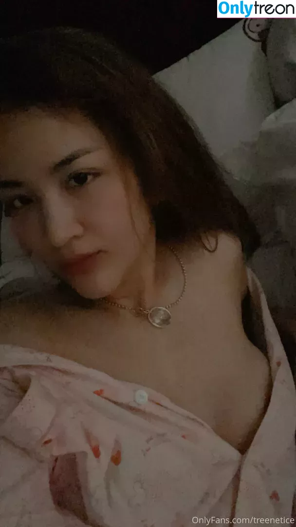 treenetpaenpet nude photo #0027 (treenet_ice)