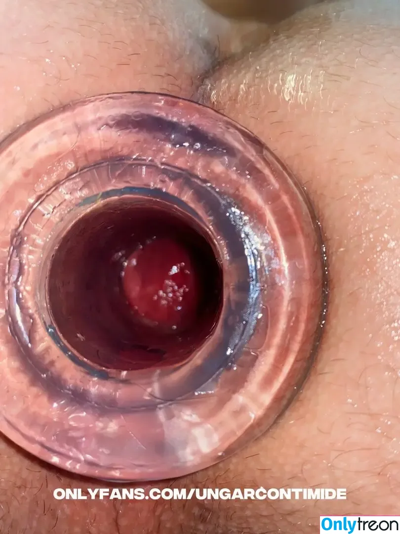 ungarcontimide nude photo #0020 (un.garcon.timide)