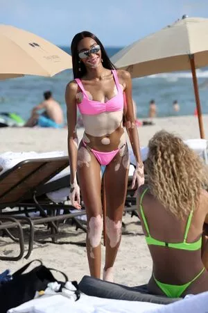 Winnie Harlow / winnieharlow фото голая #0098