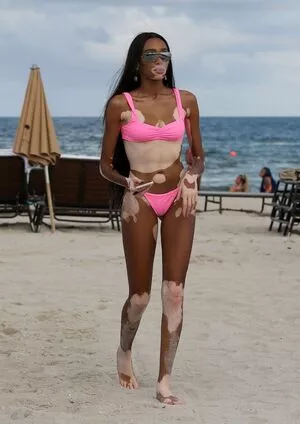 Winnie Harlow / winnieharlow фото голая #0099