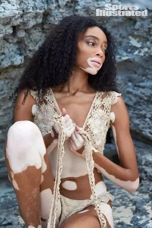 Winnie Harlow / winnieharlow фото голая #0102