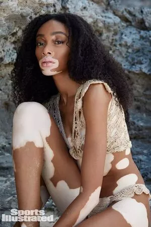 Winnie Harlow / winnieharlow фото голая #0103