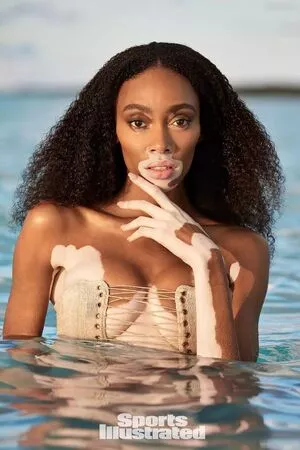 Winnie Harlow / winnieharlow фото голая #0108
