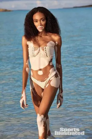 Winnie Harlow / winnieharlow фото голая #0109