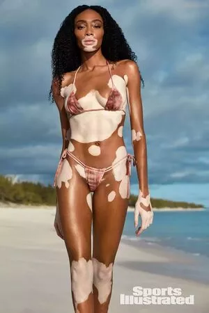 Winnie Harlow / winnieharlow фото голая #0111