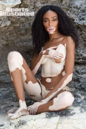 Winnie Harlow / winnieharlow фото голая #0114