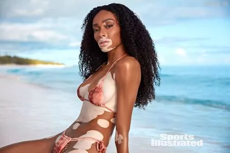 Winnie Harlow / winnieharlow фото голая #0115
