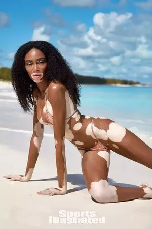Winnie Harlow / winnieharlow фото голая #0117