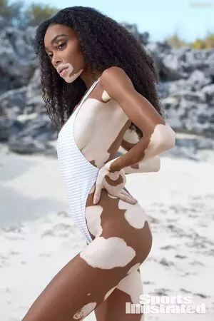 Winnie Harlow / winnieharlow фото голая #0122
