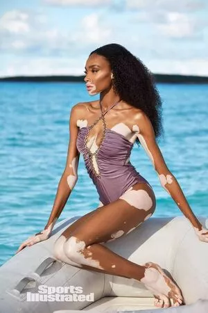 Winnie Harlow / winnieharlow фото голая #0128