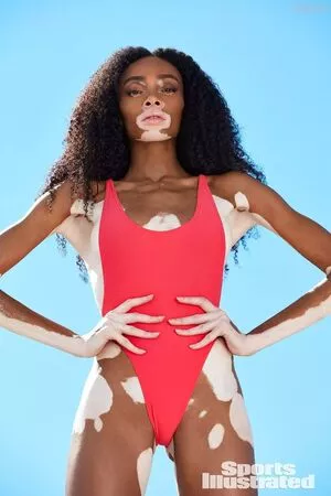 Winnie Harlow / winnieharlow фото голая #0137