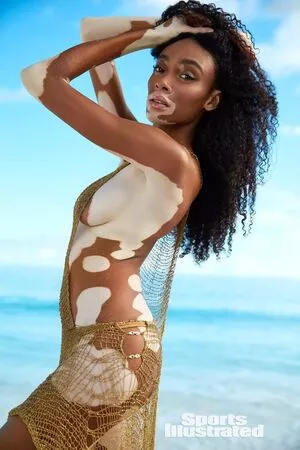 Winnie Harlow / winnieharlow фото голая #0140